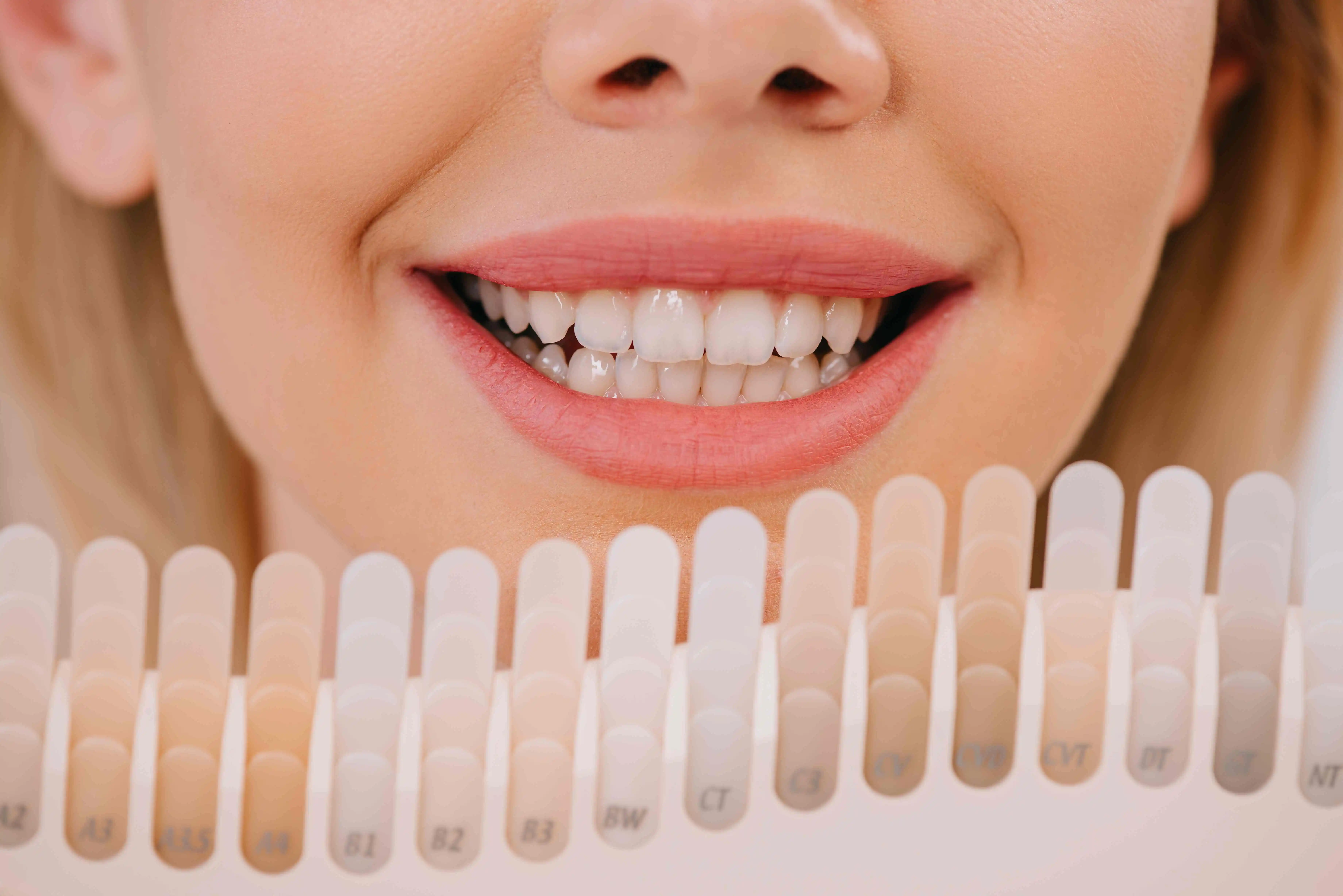 Alternative Methods of Teeth Whitening