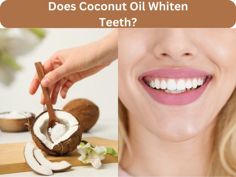 Does Coconut Oil Whiten Teeth