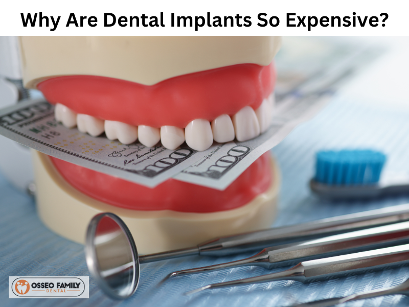 Why Are Dental Implants So Expensive