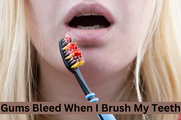 Why Do My Gums Bleed When I Brush My Teeth