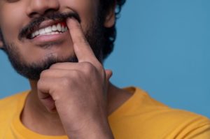 types of gum disease