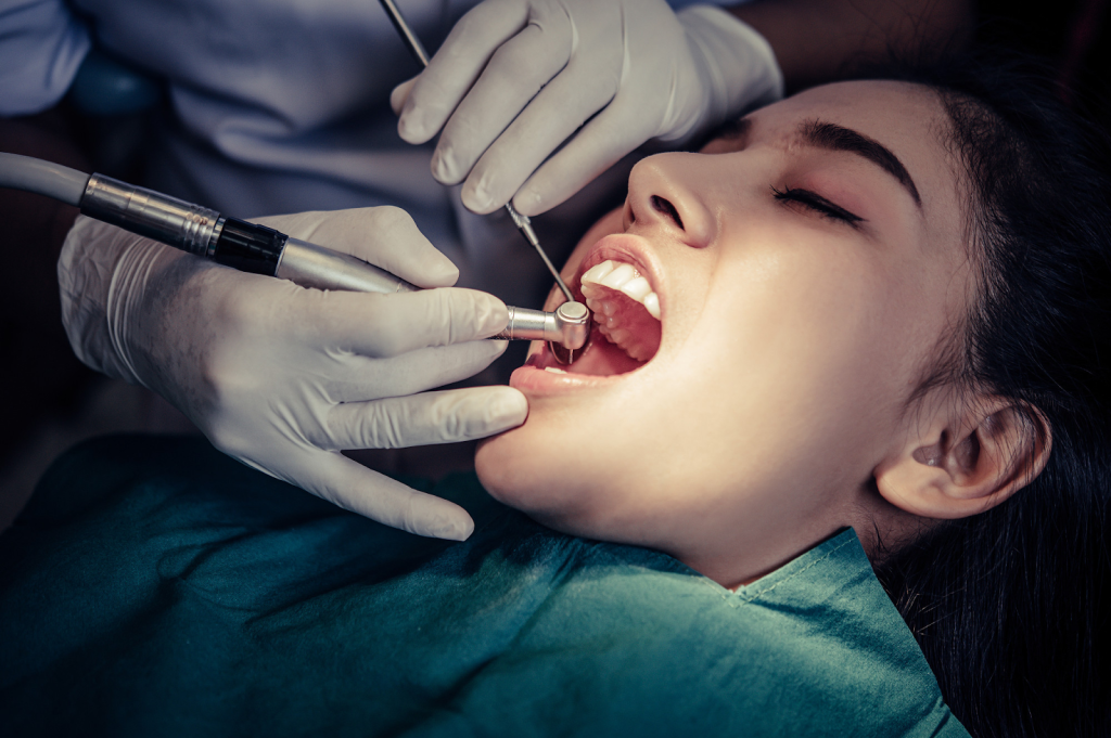 wisdom tooth abscess stages