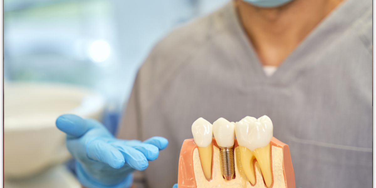 Dental Implant Healing Stages