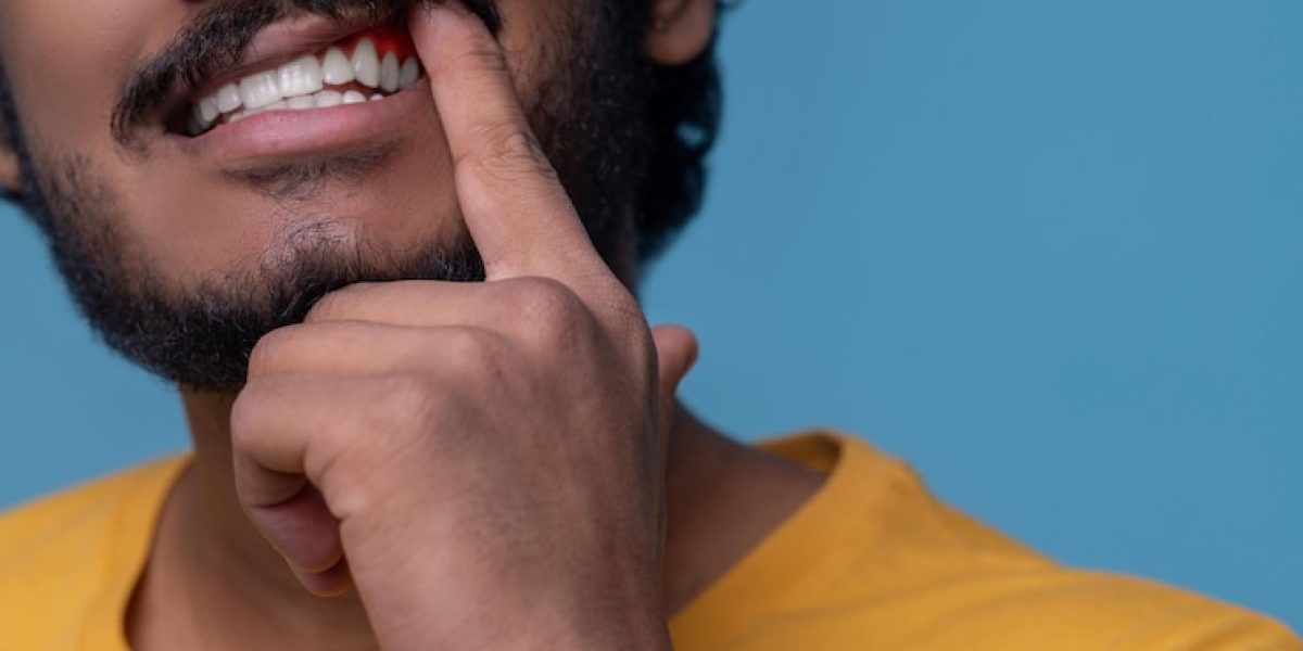 types of gum disease