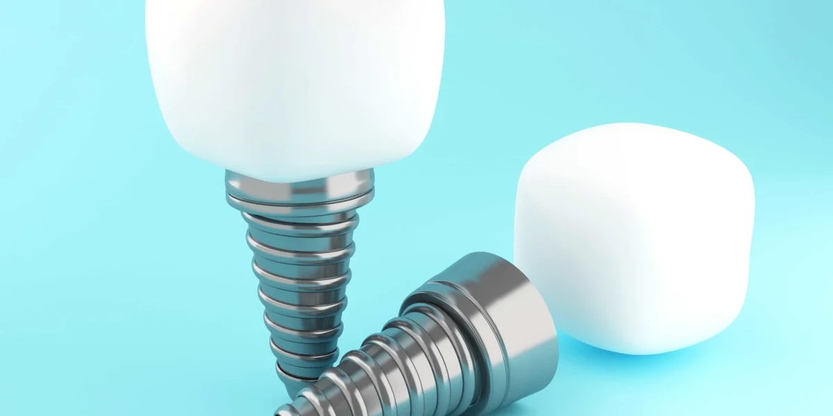 are dental implants painful
