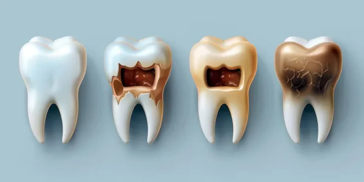 dead tooth