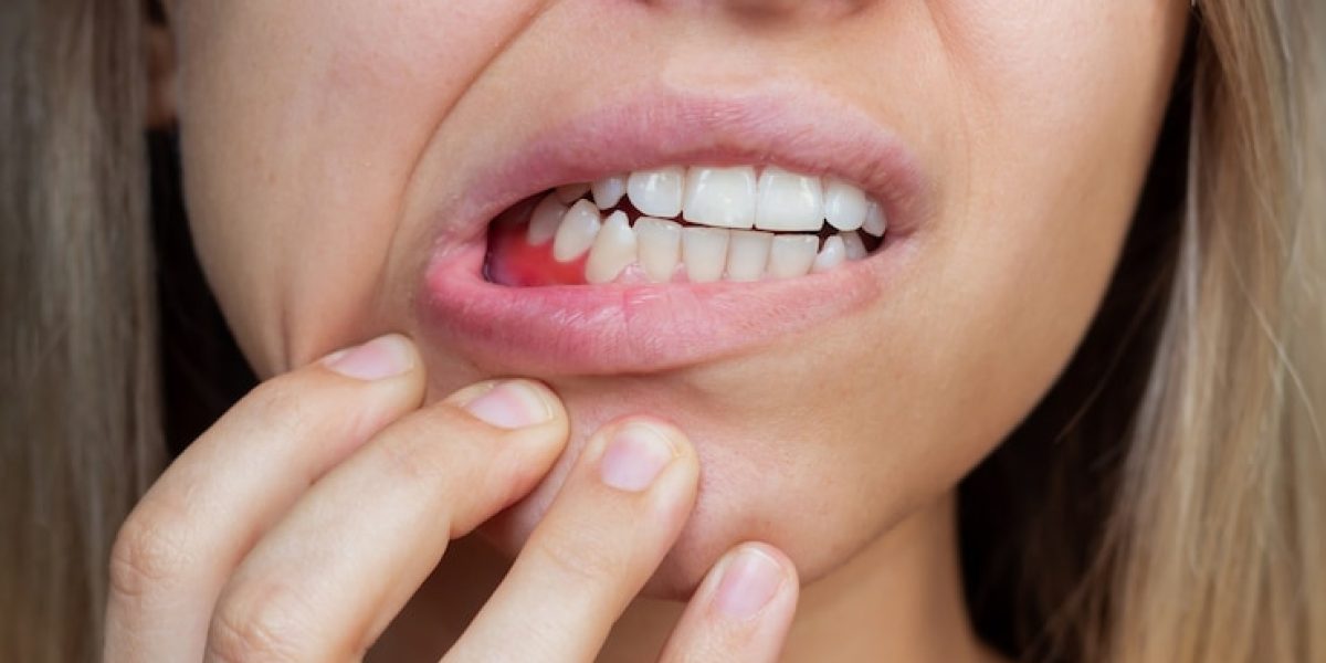swollen gums