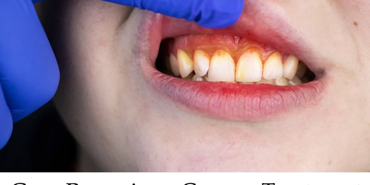 Gum Recession