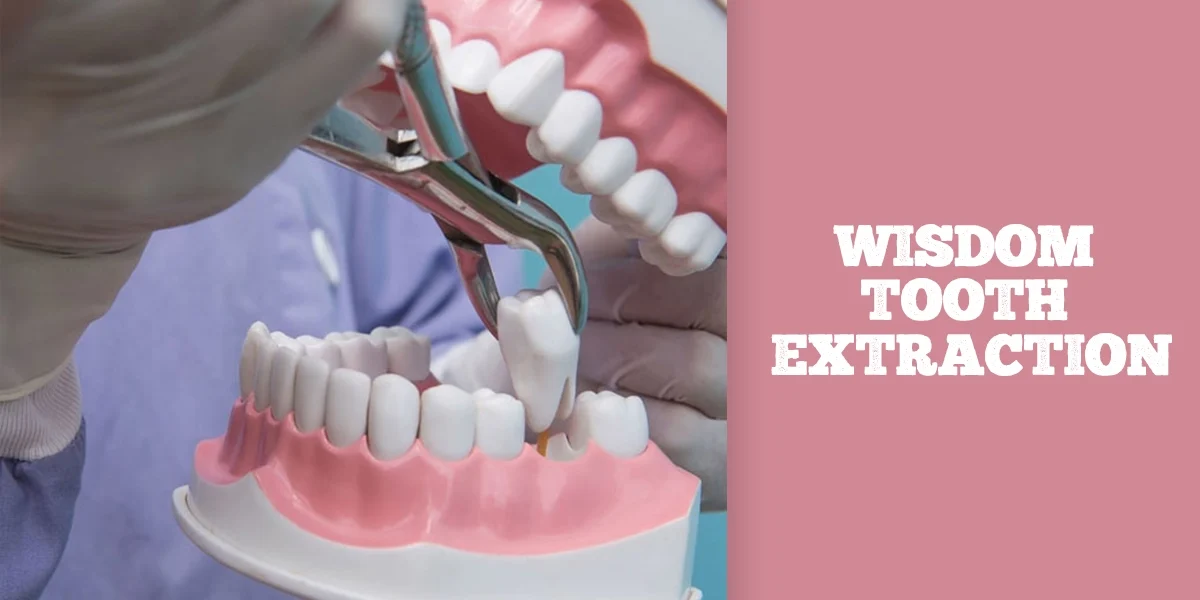 wisdom-tooth-extraction